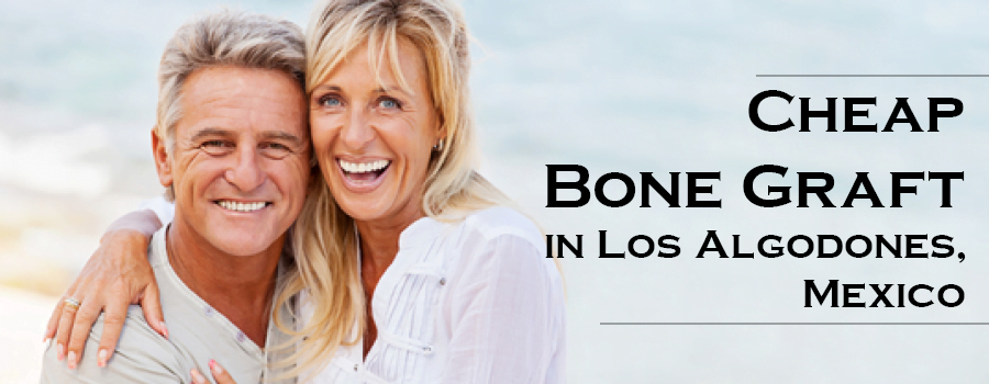 cheap-bone-graft-in-los-algodones-mexico_banner