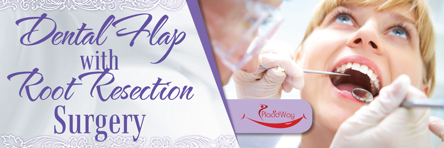 flap-with-root-resection-surgery-1