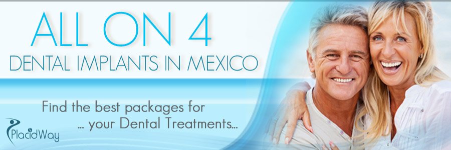 dental-implants-mexico-all-on-4