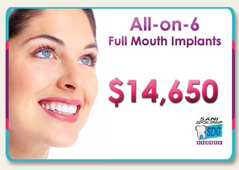 full-mouth