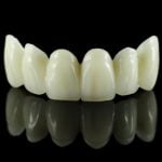 Top 5 Dental Procedures in Mexico Top 5 Dental Procedures in Mexico
