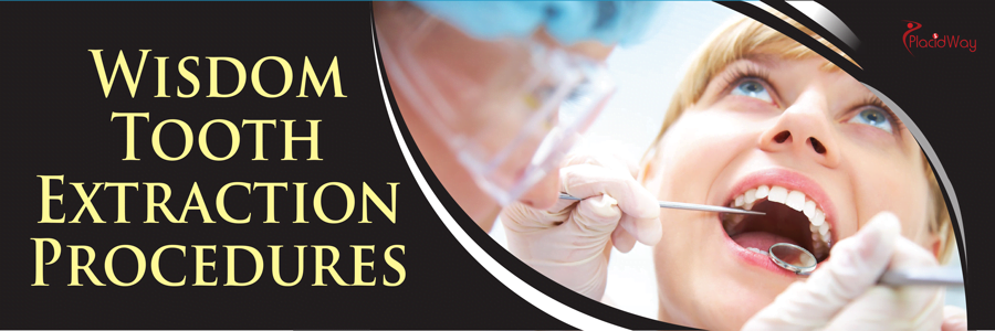 wisdom-tooth-extraction
